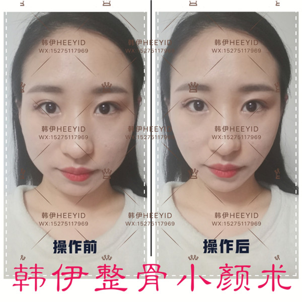 青岛小颜整骨培训