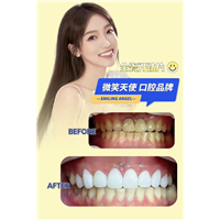 上海哪里做牙齿贴面比较好谁知道