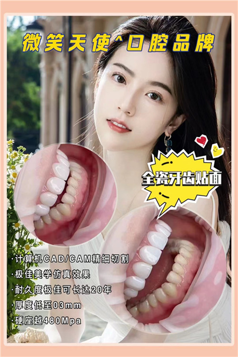 上海哪里做牙齿贴面修复可靠正规的
