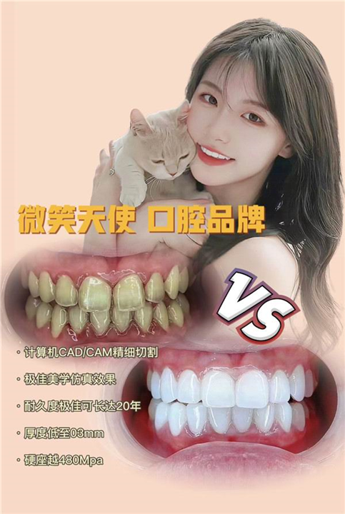 上海哪里做牙贴面好