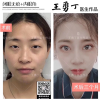 王勇丁眼综合整形专家