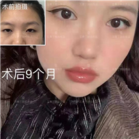 王勇丁整形