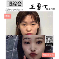 成都眼综合修复专家