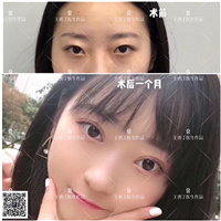 成都眼部整形专家