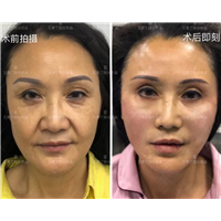 王勇丁专家