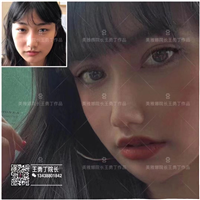 成都眼综合整形专家