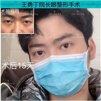 成都眼综合整形哪家好