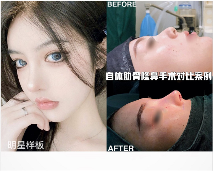上海久雅整形医院鼻整形