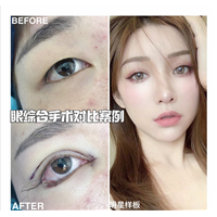 上海久雅整形医院做双眼皮怎么样