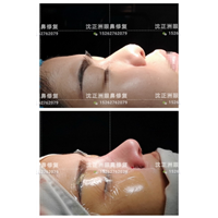 沈正洲整形专家