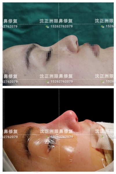 沈正洲整形专家 