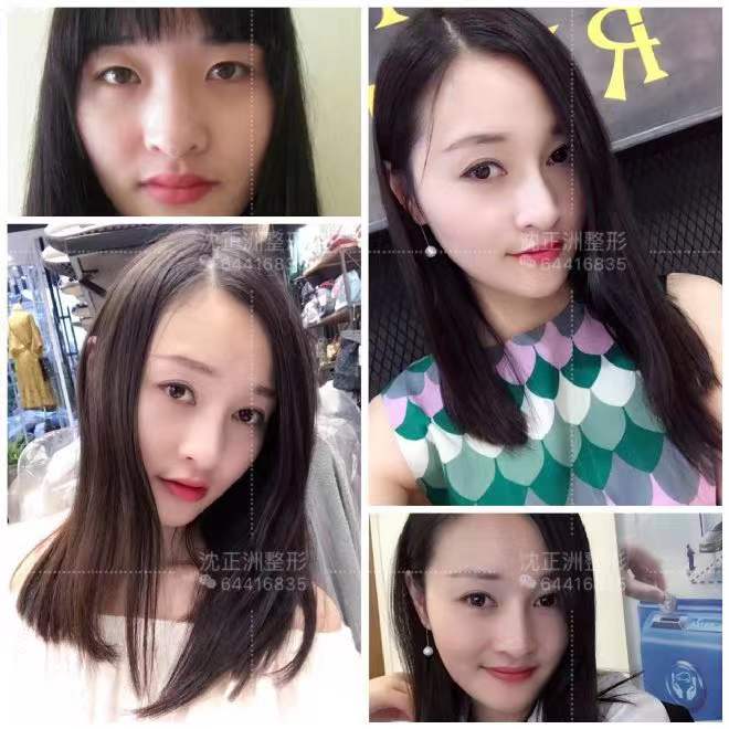 沈正洲