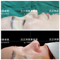 沈正洲整形专家 