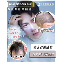 植发整形案例