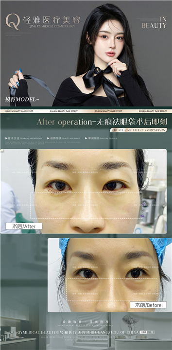 许瑞莹