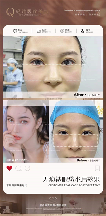 广州轻雅整形许瑞莹