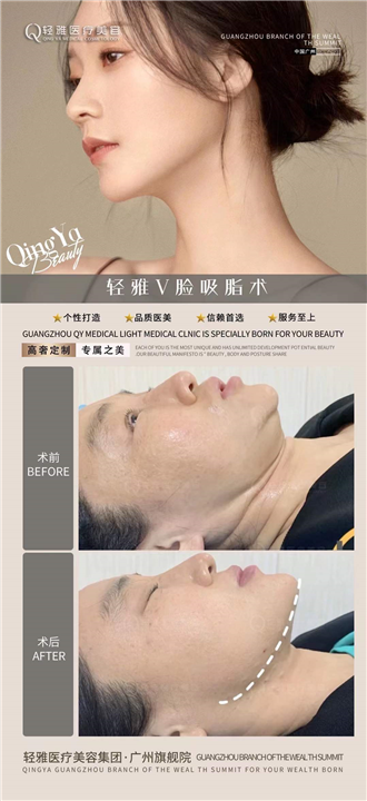 广州许瑞莹