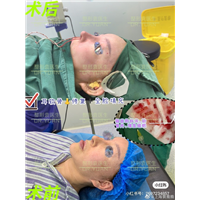 上海袁鹿鹿整形医生