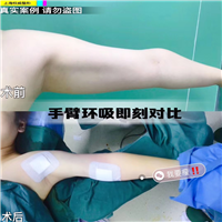 袁鹿鹿整形医生