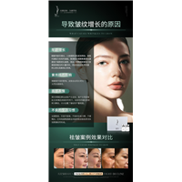 导致皱纹增长的原因