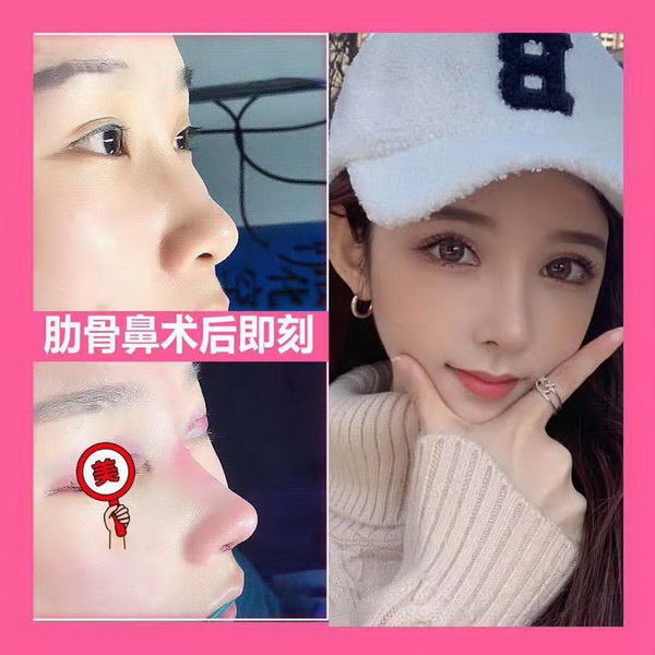 上海隆胸整形