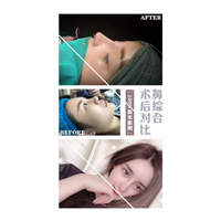 上海隆胸整形