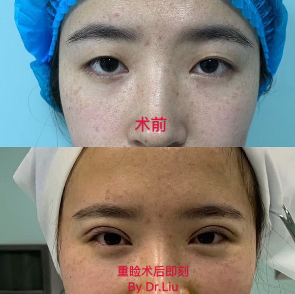 云南微整形