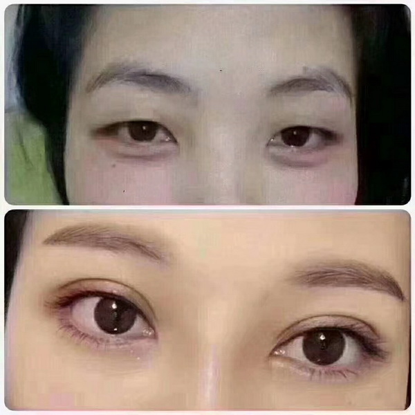 刘垠医生