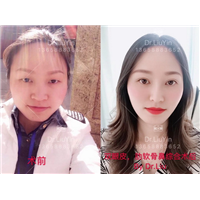 云南微整形