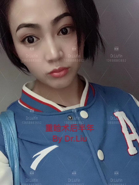 刘垠医生
