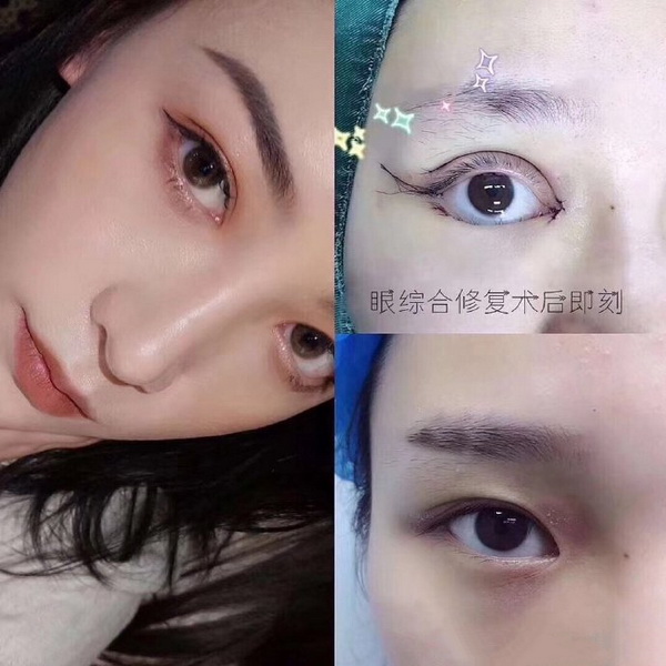 刘垠医生