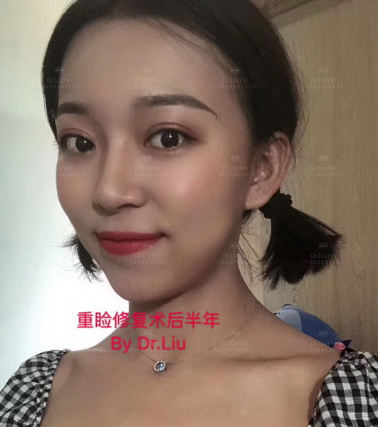 云南微整形