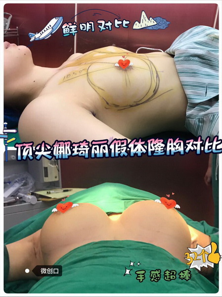 刘垠