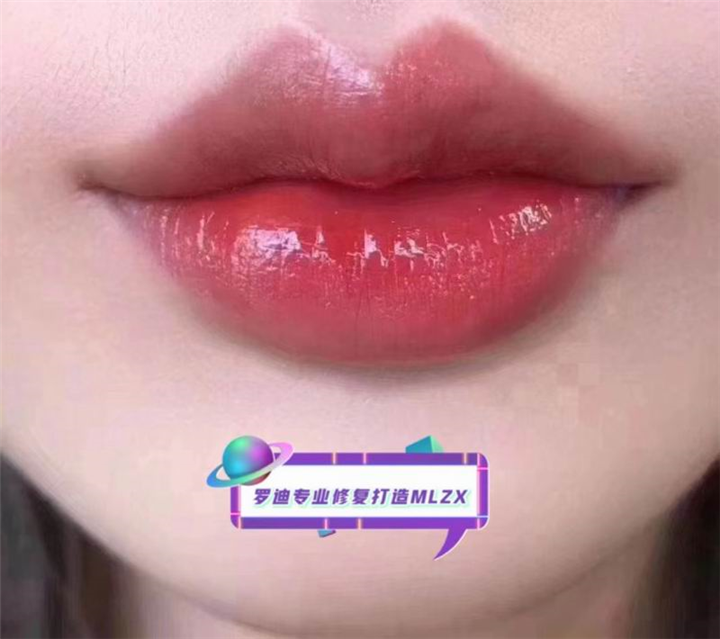 上海网红整形
