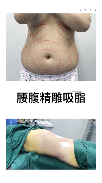 上海安禾美阁整形医院联系方式