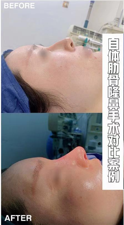 上海人气整形医院
