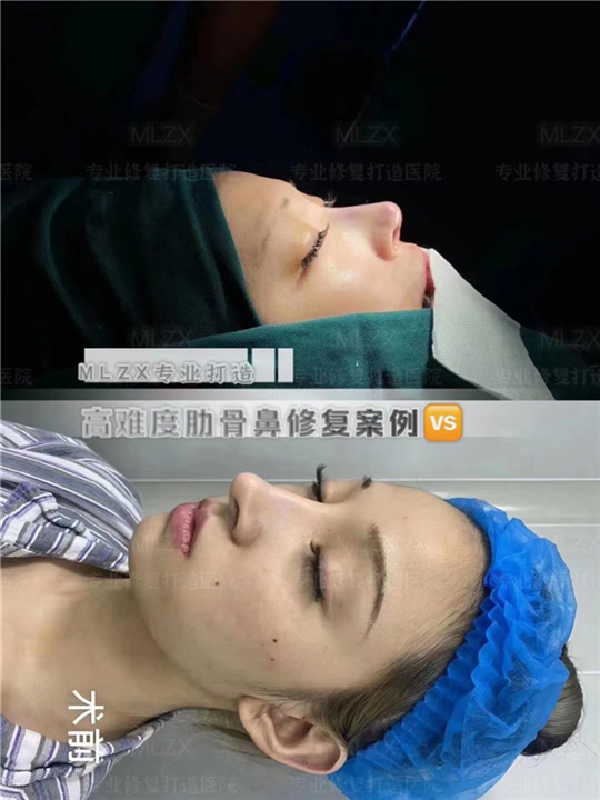 上海鼻整形医院