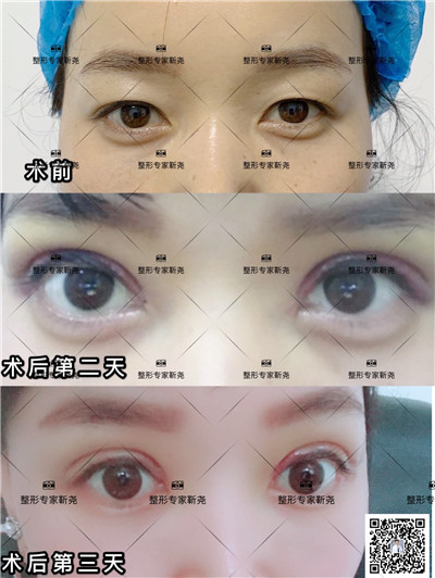 西安眼综合整形专家 