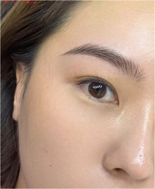 还原出生眉