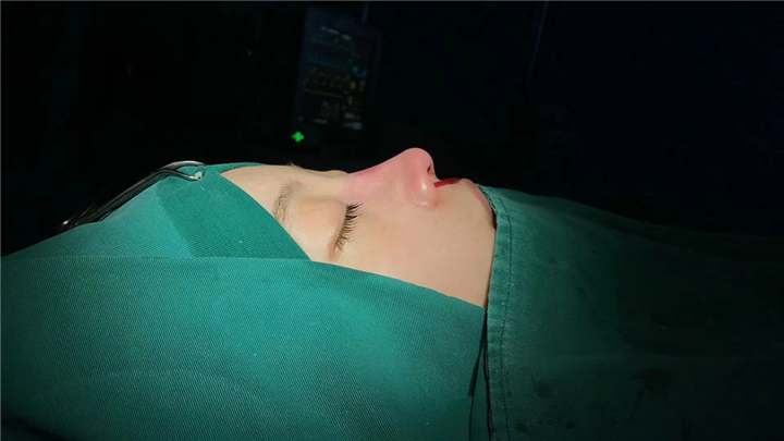 上海娜慕医疗美容鼻整形