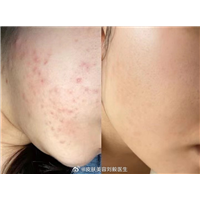 皱纹“喜欢”的食物找到了！医生：不想被叫黄脸婆，能不吃就不吃