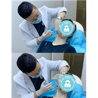 刘毅整形医生“轮廓固定到底怎么做？”