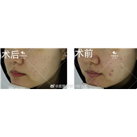 杭州轻医美抗衰老
