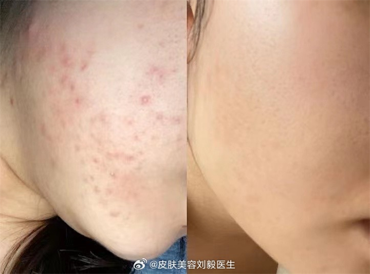 皱纹“喜欢”的食物找到了！医生：不想被叫黄脸婆，能不吃就不吃