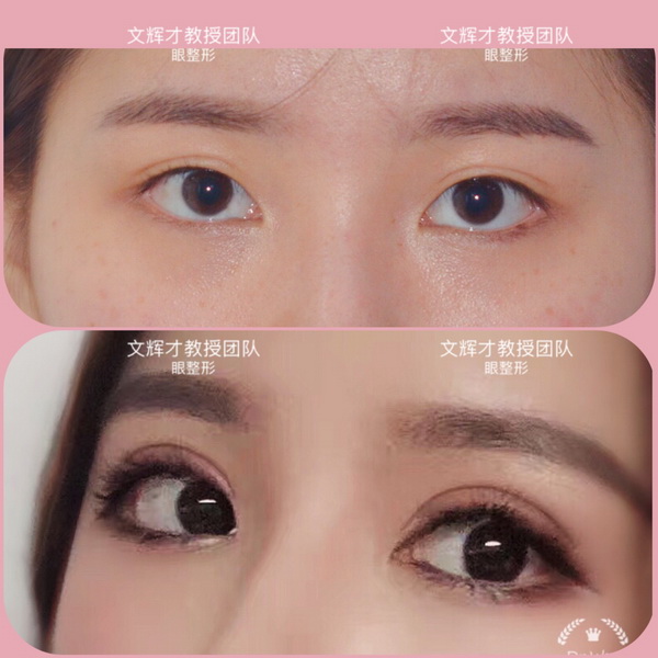 南昌鼻整形专家
