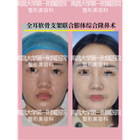 文辉才医生技术好吗 