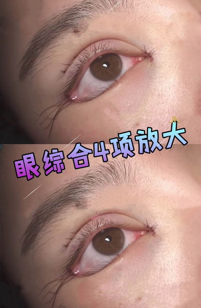 广州专业整形修复 