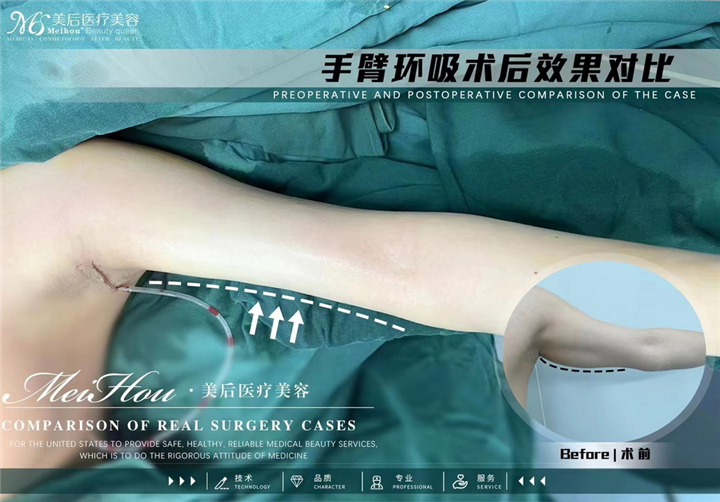 广州美后医疗美容医院