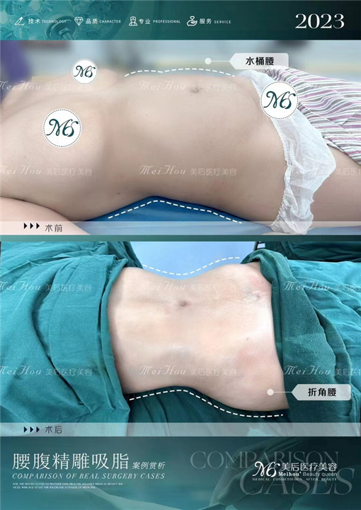 广州美后医疗美容医院