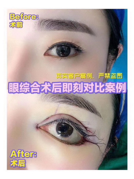 广州专业整形修复 